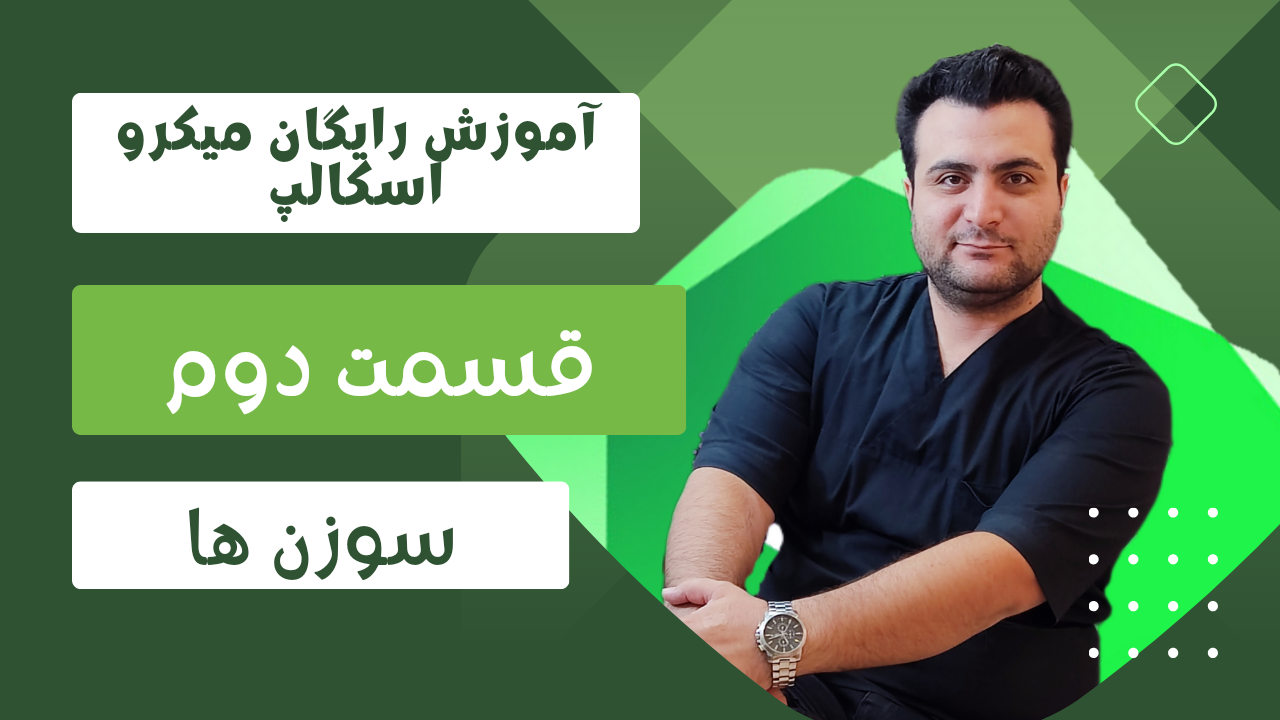 میکرواسکالپ در کرج میکرواسکالپ در کرج