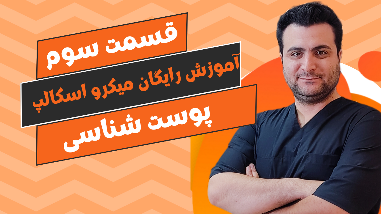 میکرواسکالپ در کرج میکرواسکالپ در کرج