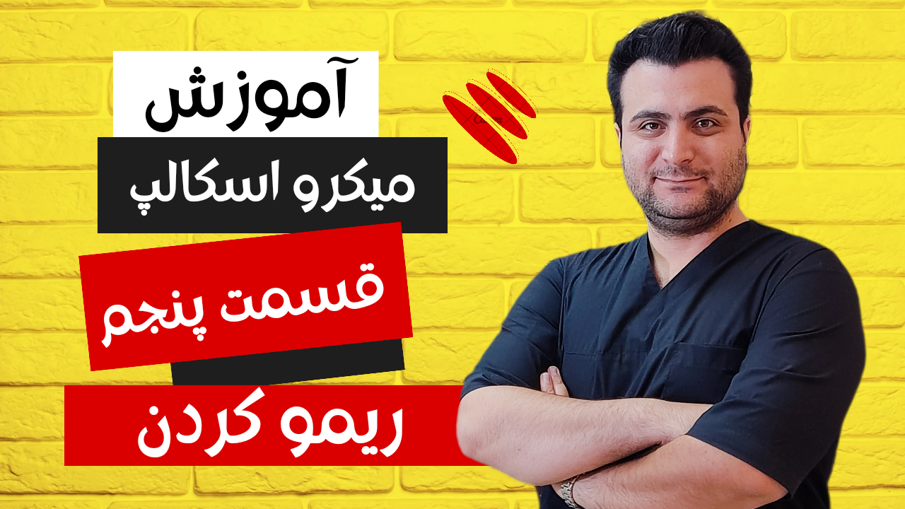 میکرواسکالپ در کرج میکرواسکالپ در کرج