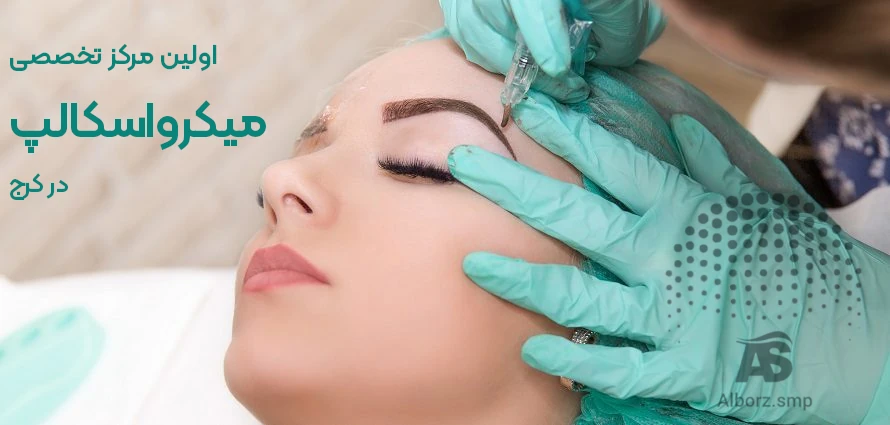 میکرواسکالپ در کرج