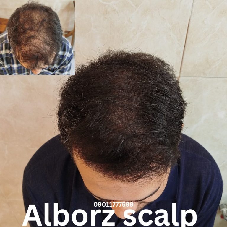نمونه کار البرز اسکالپ