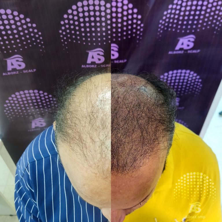 نمونه کار البرز اسکالپ