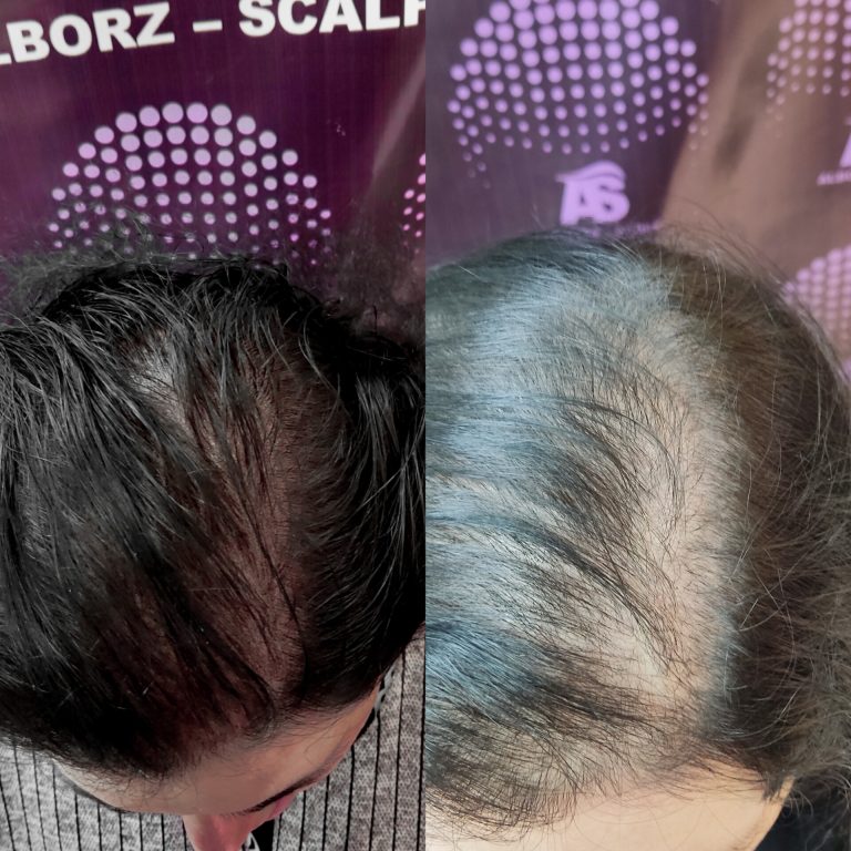 نمونه کار البرز اسکالپ