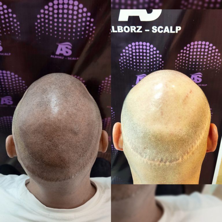 نمونه کار البرز اسکالپ