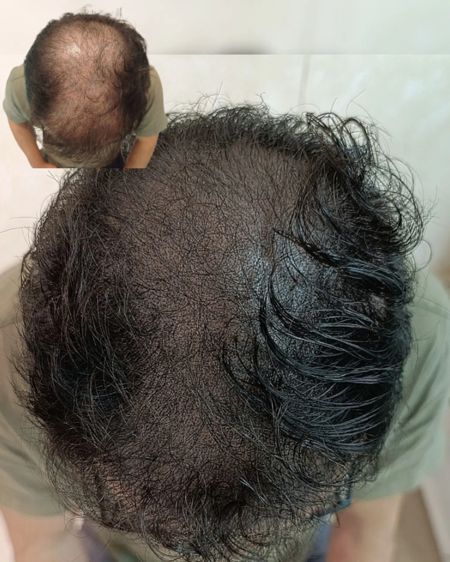 نمونه میکرواسکالپ