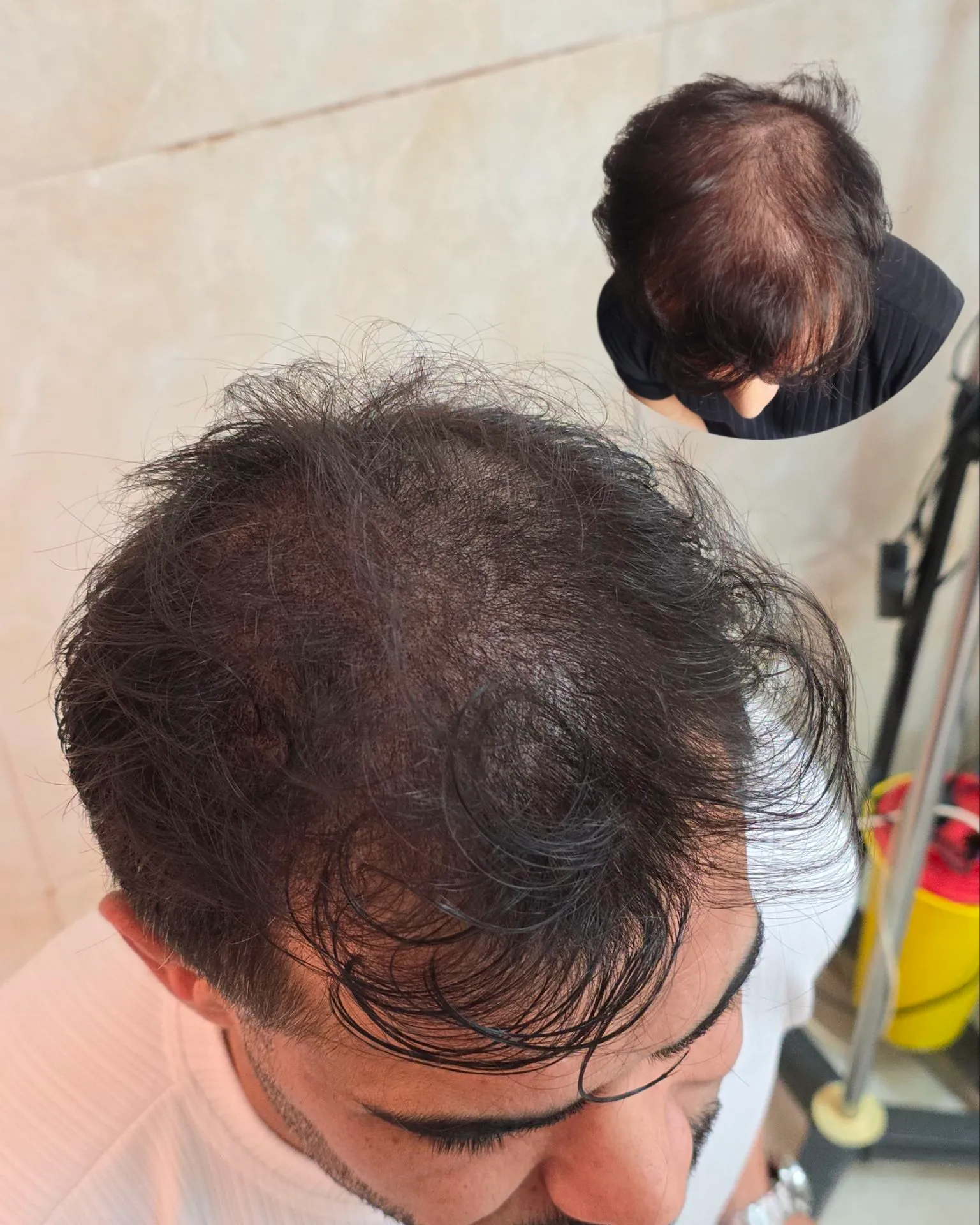 نمونه میکرواسکالپ