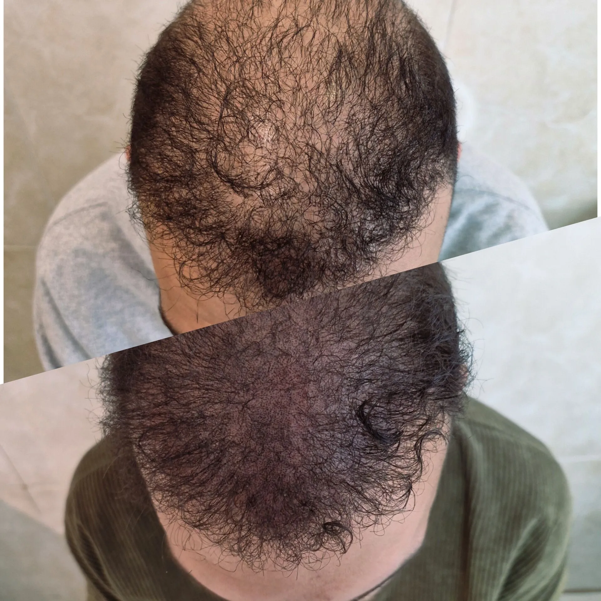 نمونه میکرواسکالپ